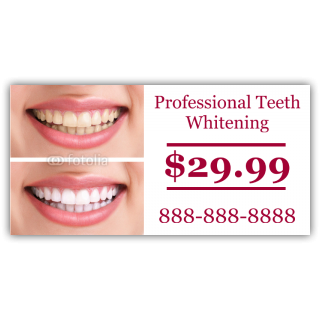 Professional Teeth Whitening $29.99
